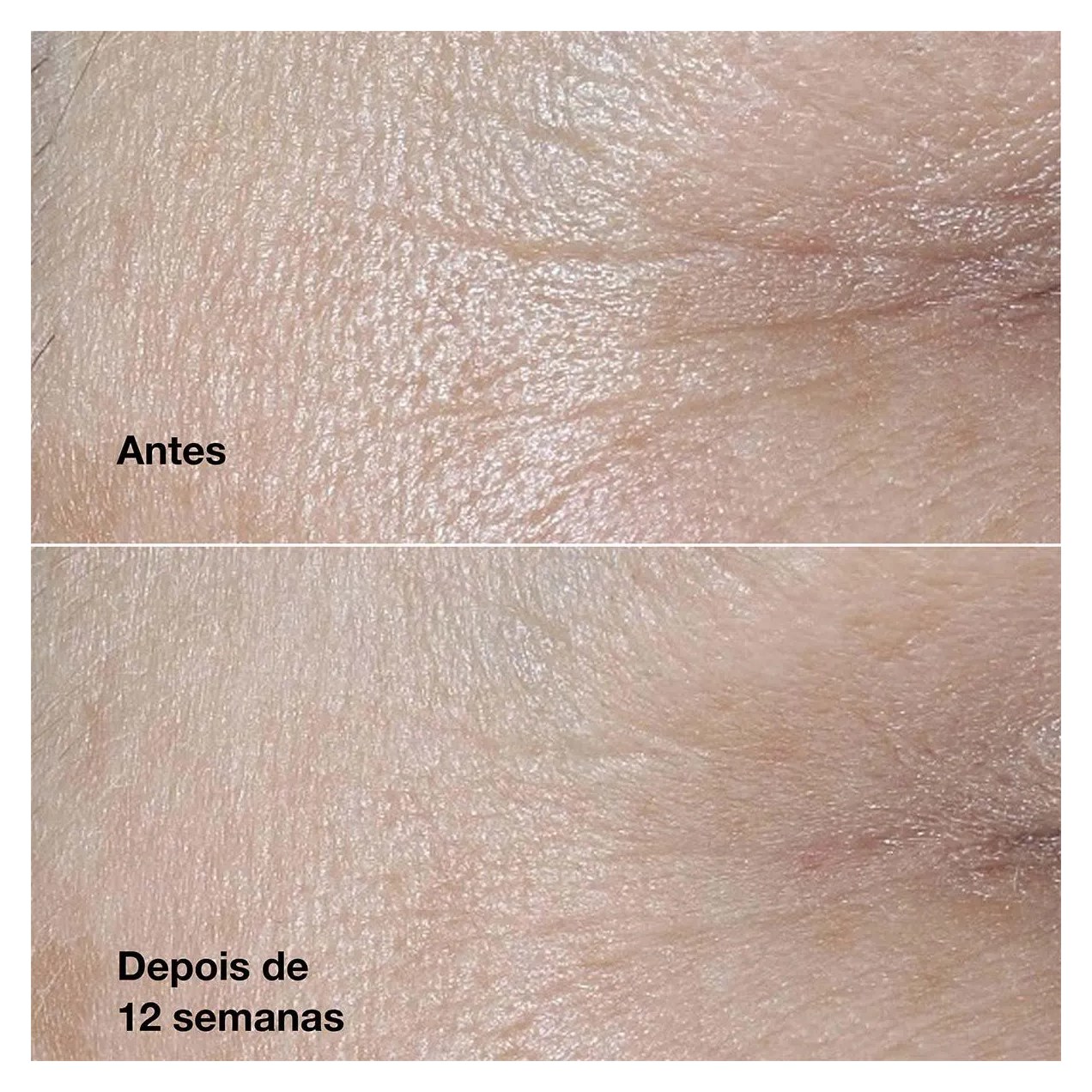 Creme Antirrugas Smart Clinical Repair 50ml